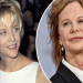meg ryan and plastic surgery