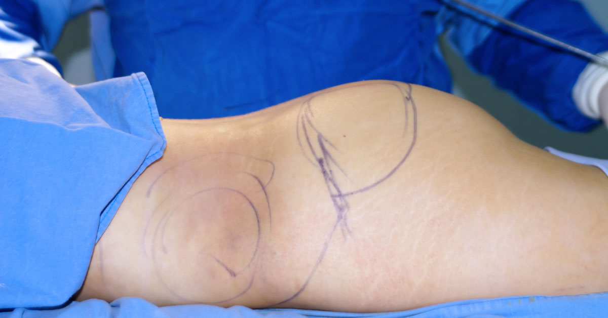 what does bbl dizzy mean