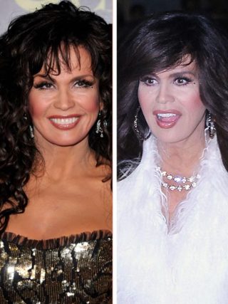 marie osmond facelift