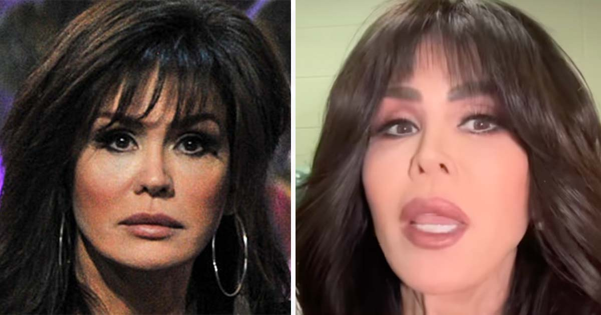marie osmond facelift