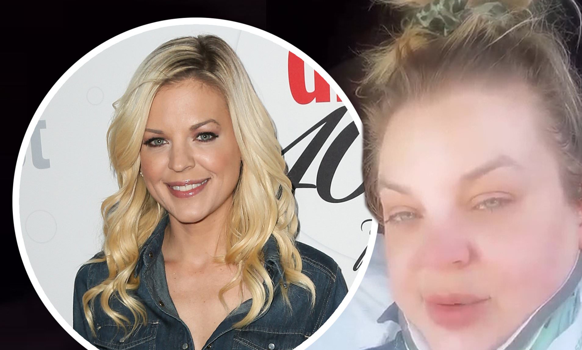 kirsten storms brain surgery