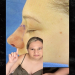 gypsy rose rhinoplasty
